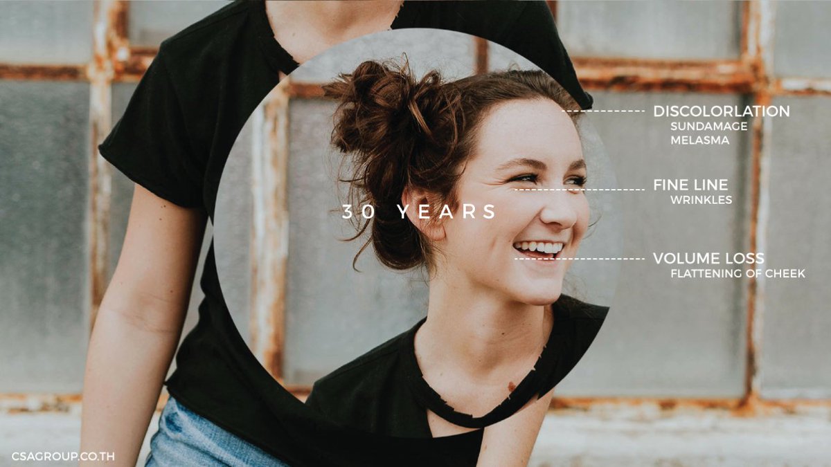 GroupCsa's tweet image. #CSATalk 20 ปีผิวมีคอลลาเจนมาก แต่อาจถูกทำร้ายแสงแดด อนุมูลอิสระจนลดการสร้างเซลล์ผิวใหม่และอัตราการผลัดเซลล์ได้ ► bit.ly/2wU7xsL