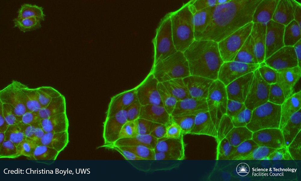 Find out how technology designed to help detect #GravitationalWaves is now helping to grow human bones: socsi.in/n5lTe