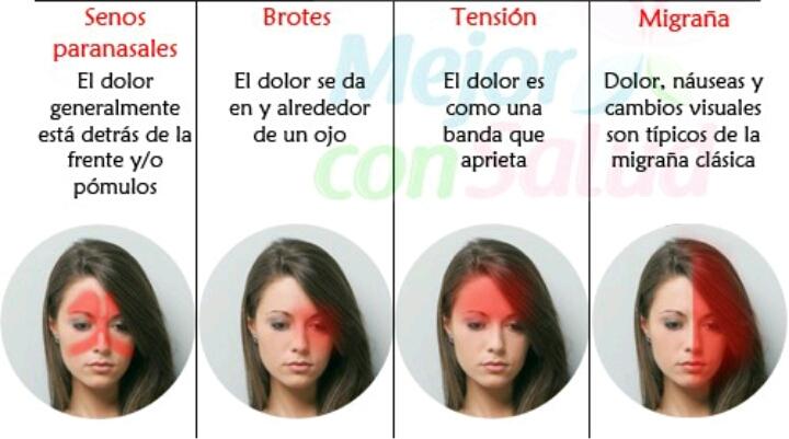minsaludlaguair's tweet photo. Conoce las diferencias #12Sep #DiaInternacionalDeLaMigraña https://t.co/UFRS79tCOg
