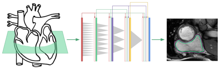 Heart Disease Diagnosis with Deep Learning - state of the art results with 60x fewer parameters goo.gl/y3hdnw #deeplearning #ai