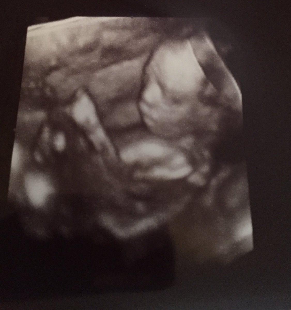 JT 🇺🇦 tweet media