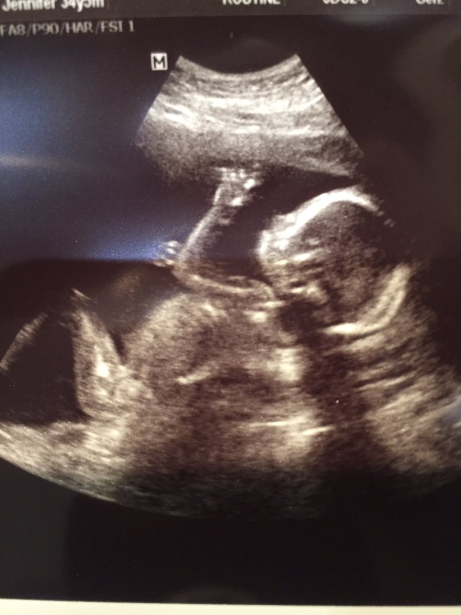 JT 🇺🇦 tweet media