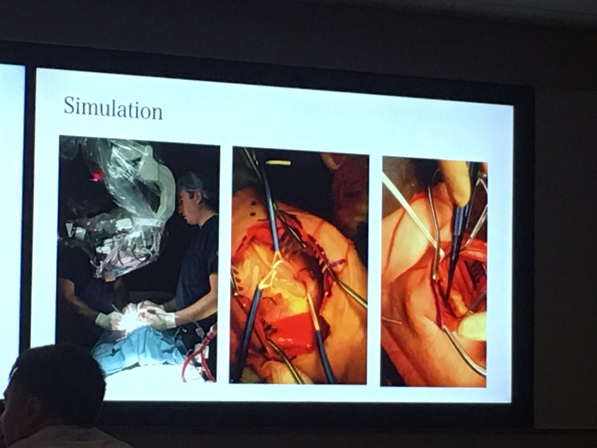 Mount Sinai Cerebrovascular tweet media
