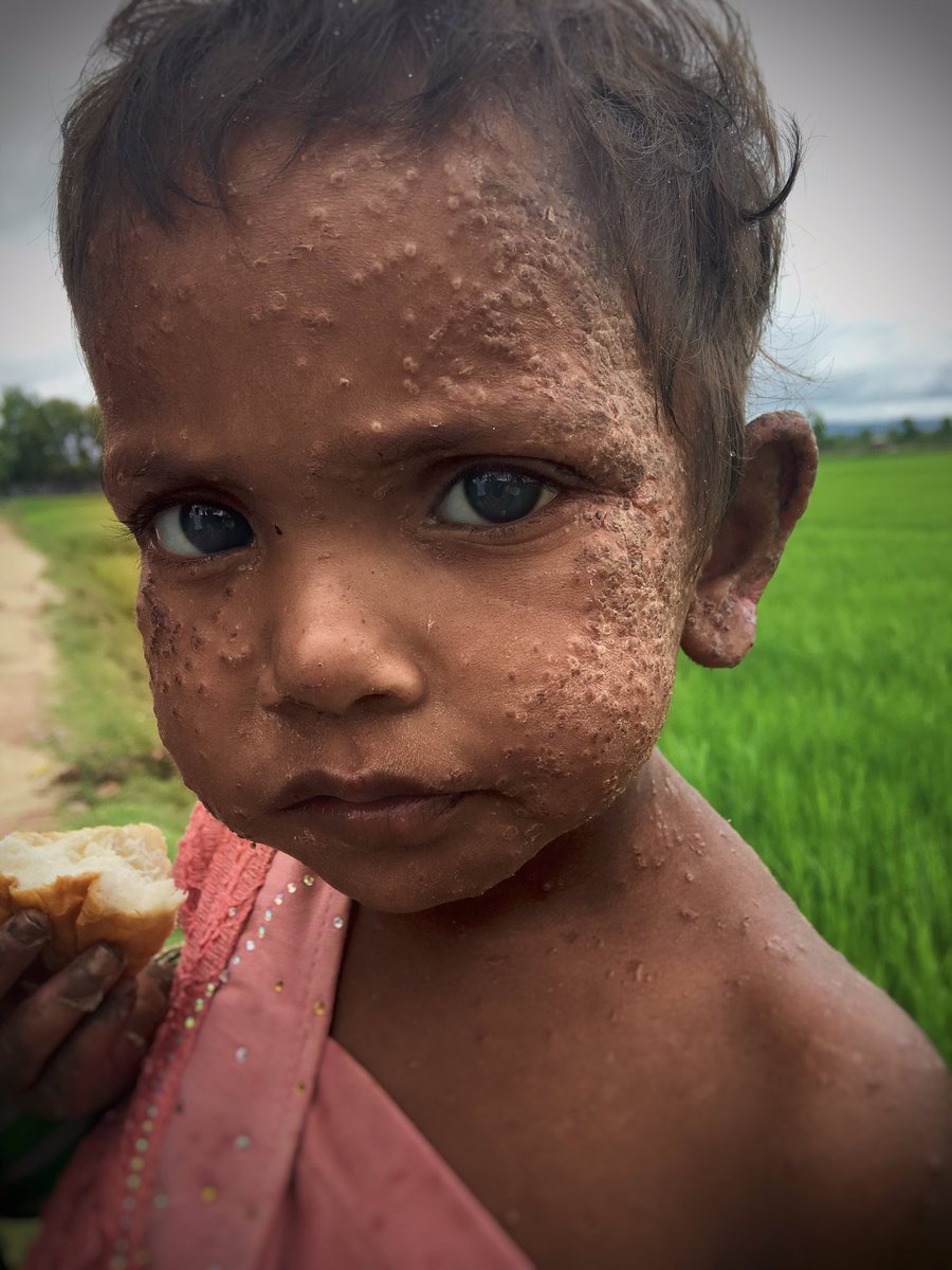 Ahmed_Afgani's tweet photo. #Rohingya child. Her 4 bro died on journey over border. 2 shot dead by Myanmar Army. 2 more starved to death https://t.co/Va2dfGcp1b