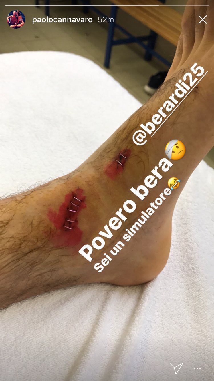 Berardi ko: a forte rischio per la Juve. I social lo irridono, Cannavaro lo difende - FOTO 39 DJr1j2EXUAAEU2N