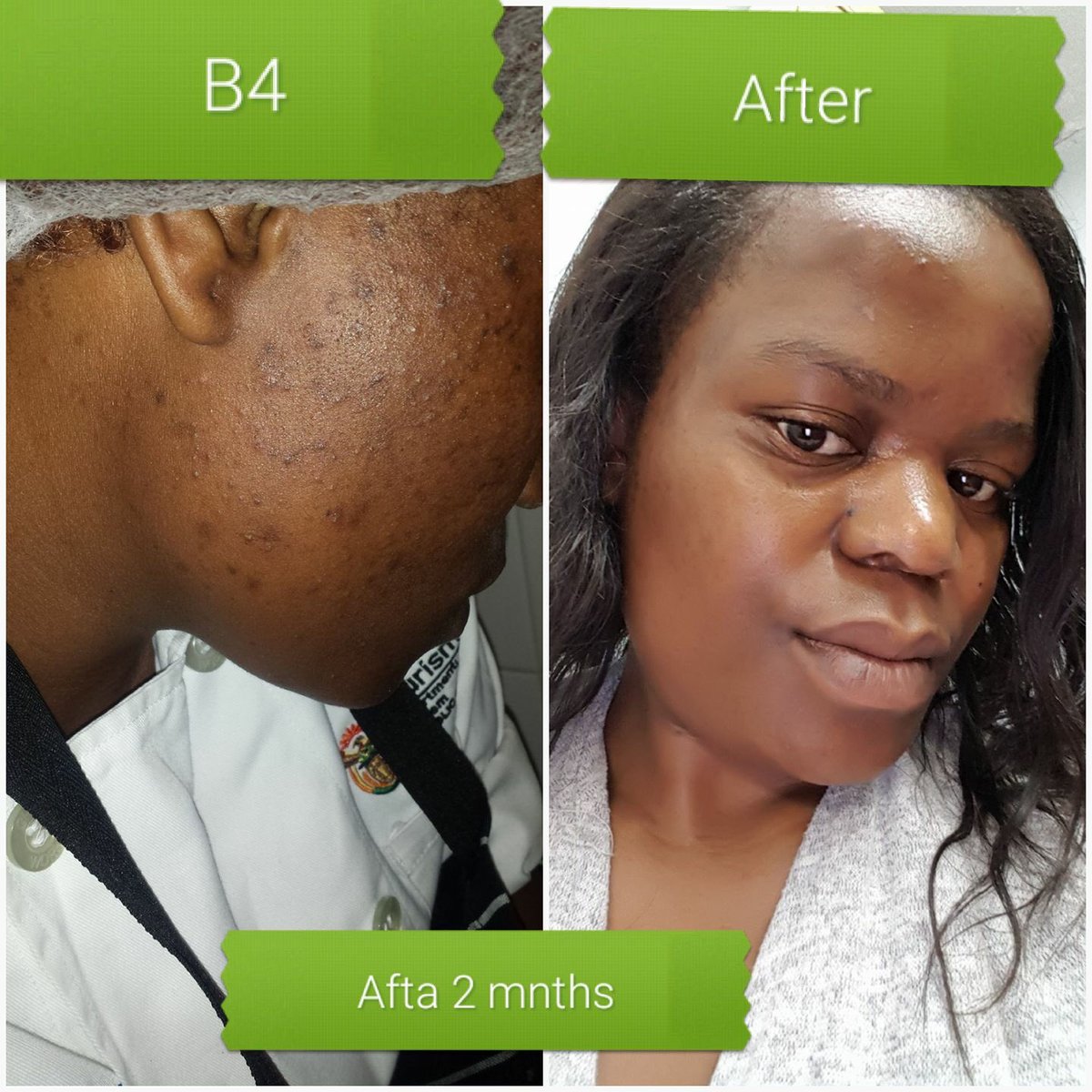 Before And After Portia M Products