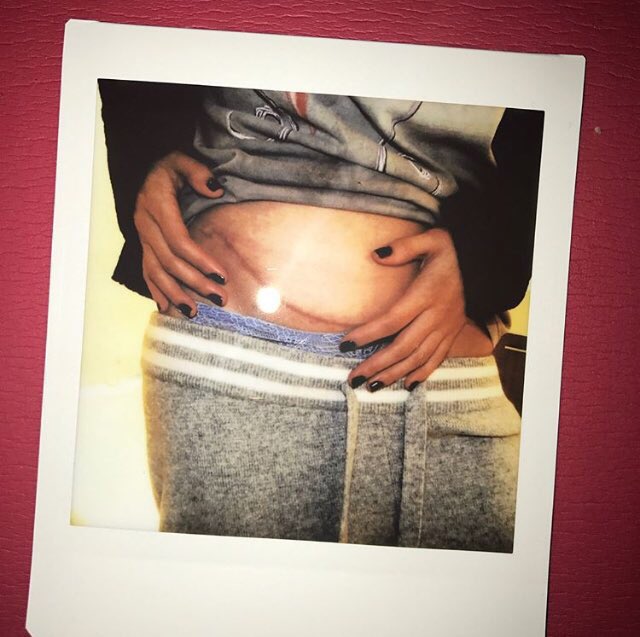 cryIngwsel's tweet photo. These photos hurt, but they are also the most beautiful, showing true friendship and a real, strong woman. #WeAreProudOfYouSelena https://t.co/AoKpVCVGxz