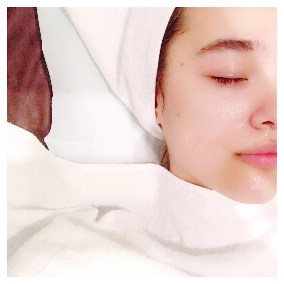 梅園 アマンダ على تويتر ピーリングと毛穴洗浄してきました 気持ちぃくらい皮脂がとれて 最近とても悩んでた小鼻や眉間 顎の ザラザラがなくなってツルンツルン お肌ケア楽しい 恵比寿医院 ピーリング 毛穴洗浄 スキンケア 美肌