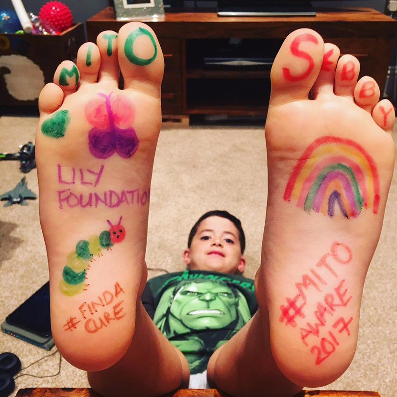 SailorSwiftBear's tweet photo. We're getting our socks off for Mitochondrial Disease Awareness Week! Share yours with #MitoAware2017 or visit https://t.co/NNRwTyADRA 🐻👣💚 https://t.co/qWRofUhiS1