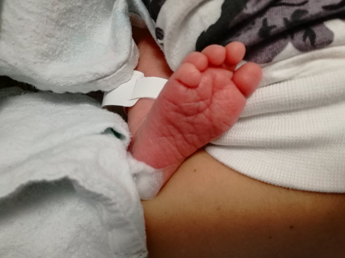 siwillmont's tweet photo. My little girl is here! #monkeyfoot https://t.co/eZ6zBj460T