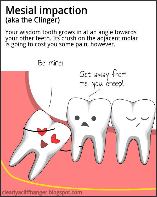 hatherleydental's tweet photo. It's #FridayEve again!! Here are some #funducational illustrations that will make you laugh AND teach you about those pesky #wisdomteeth 😂 https://t.co/bp24h9ZmHP