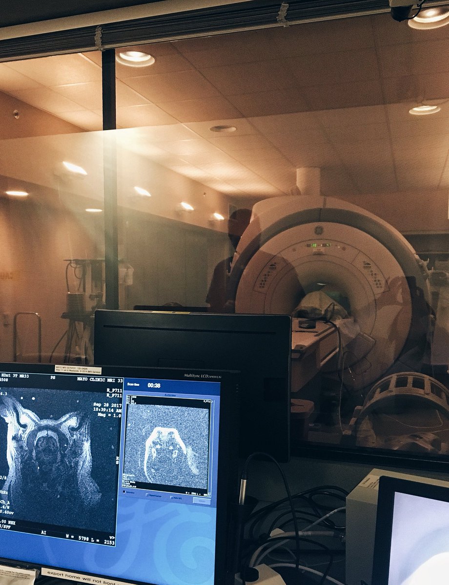 jannafur's tweet image. Spent the morning in the fMRI looking at the effects of peripheral nerve stimulation in the brain  #mayoclinic #imagingCore #labrotation1