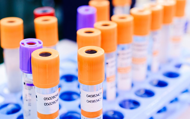 Termination for failure to comply with a reasonable and lawful direction - it's a blood sport. bit.ly/2xGs8ic