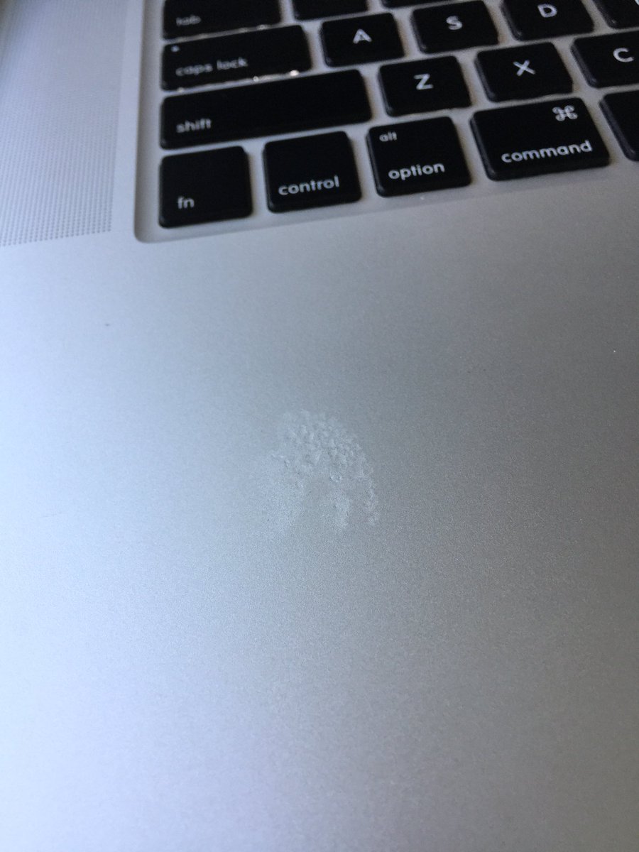 ShellyB_med's tweet image. When it’s your birthday and you submit your abstract with 26 seconds to spare #handsweat #SIR #interventionalradiology #IRresistible