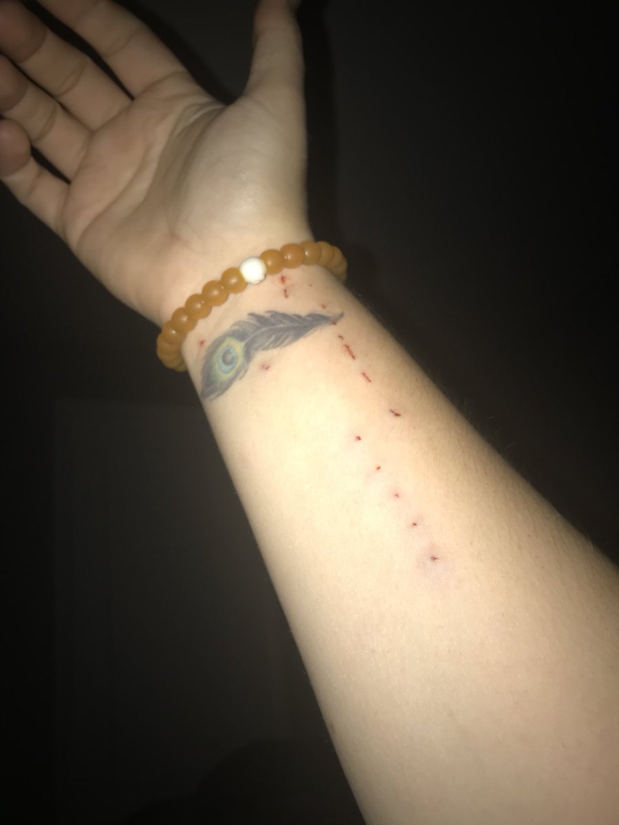 amandachensel's tweet photo. This is going to be fun to explain to people. I got into the fight with the cat #andlost https://t.co/20xapHz4EQ