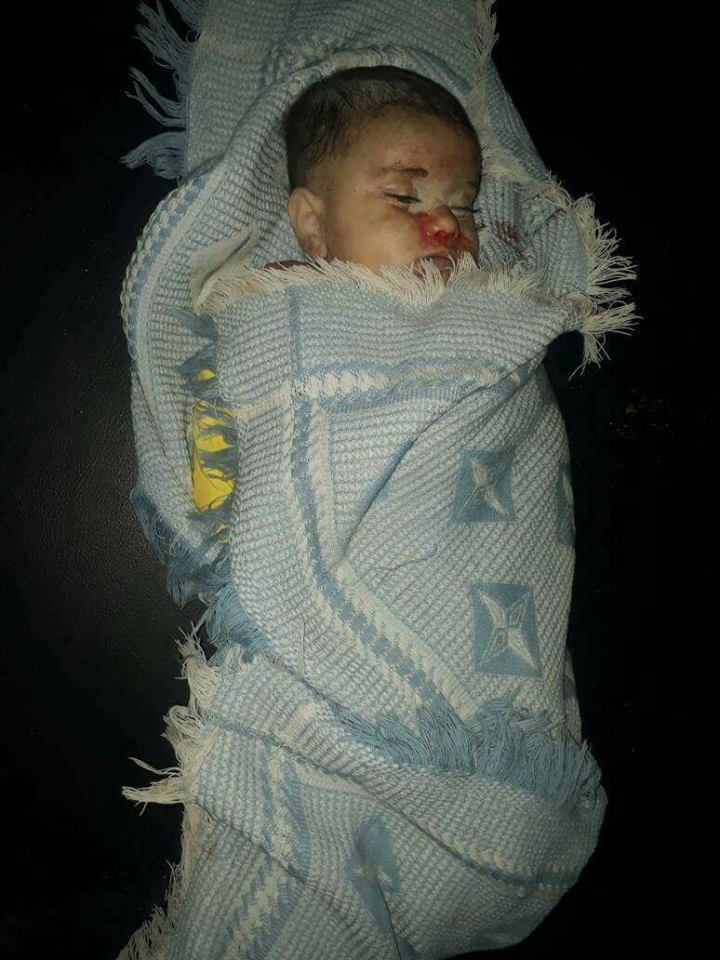 CombatChris1's tweet photo. Precious Jamila Ali al Kurdi was killed along with her uncle Mustafa al Kurdi by Regime rocket artillery in #Talbisa Homs. RIP little angel https://t.co/u5KTgYeTw5