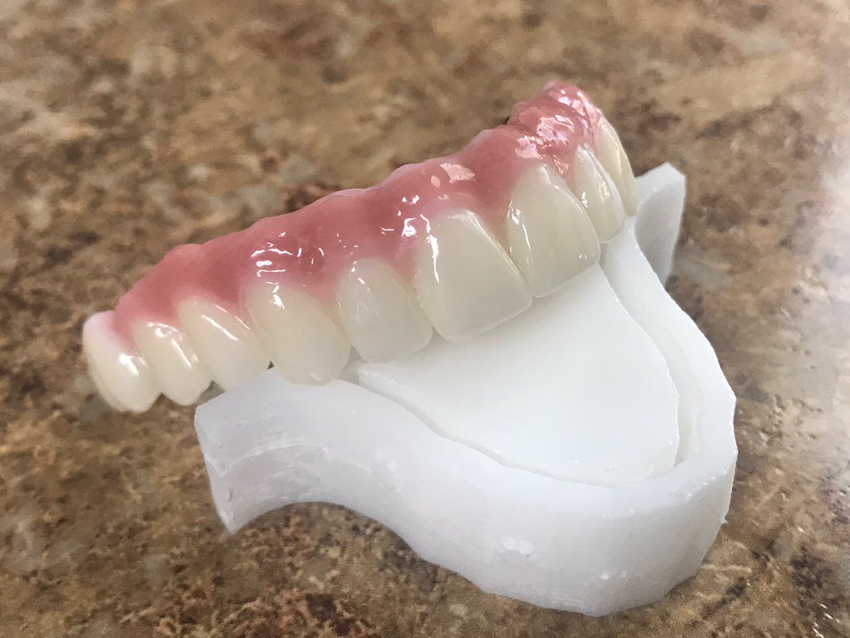 Argen_Corp's tweet photo. An #ArgenZ HT+ masterpiece! Thanks to Joe Abad Santos of Total Freedom Dental Implant Center for the images. Great work! #ArgenSmiles https://t.co/usO9xE3DUg