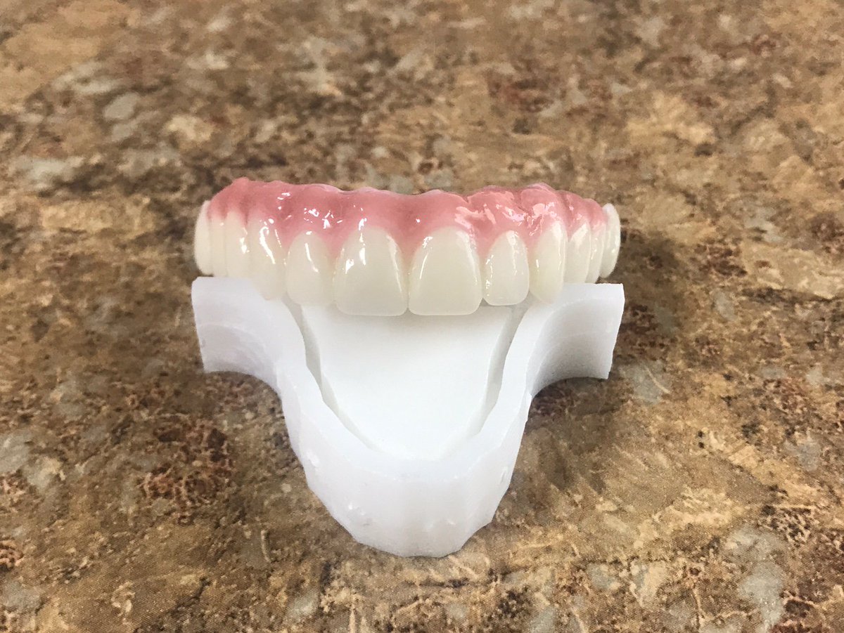 Argen_Corp's tweet photo. An #ArgenZ HT+ masterpiece! Thanks to Joe Abad Santos of Total Freedom Dental Implant Center for the images. Great work! #ArgenSmiles https://t.co/usO9xE3DUg