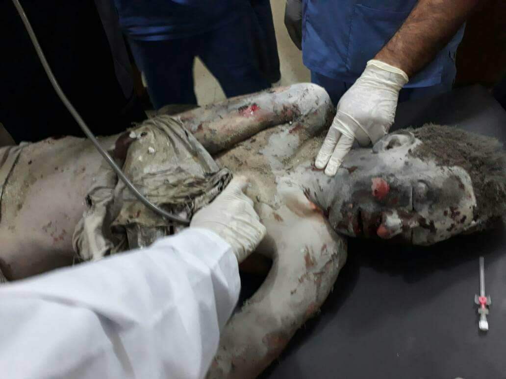 MohamdAlhoomsi's tweet photo. #Assad kills 5 people in heavy shelling on #Talbisa north of #Homs https://t.co/bHai5brDSx