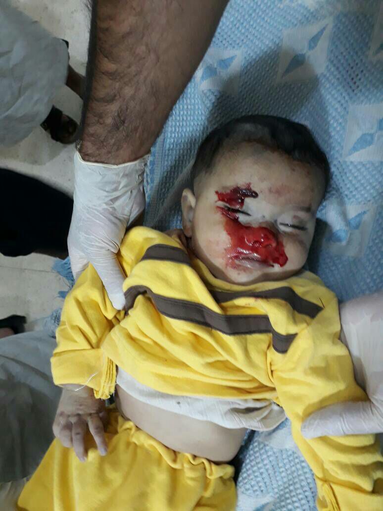 Baraa_Abdul's tweet photo. قصف روسي ليلي إستهدف أرمناز بنفس ضربات النهار ليوقع ضحايا لم يكملوا البحث عن أشلاء محبيهم ومفقوديهم
قاتل الله الظلم وقاتل الله الظالمين https://t.co/niZDKgHQWO