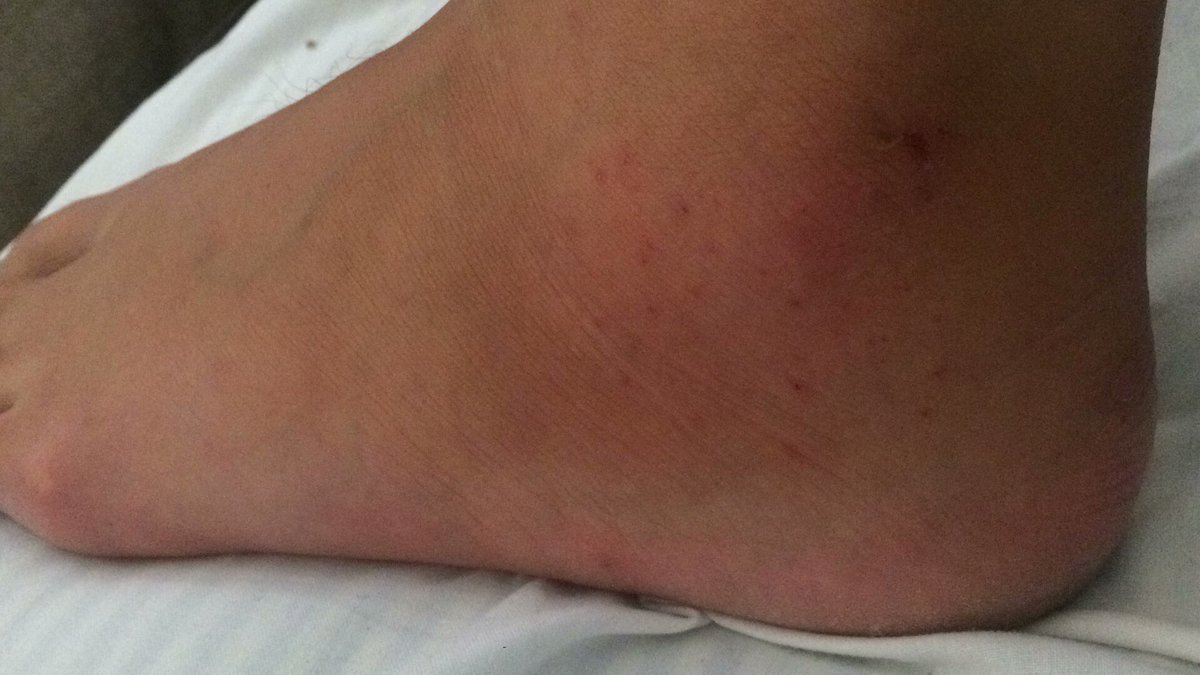 Pequeño susto en un entrenamiento, veremos que es finalmente. Hoy vuelvo a casa , gracias Marruecos por el aprendizaje 🇲🇦💪🏻 <a href="/becaspodium/">Becas Podium</a>