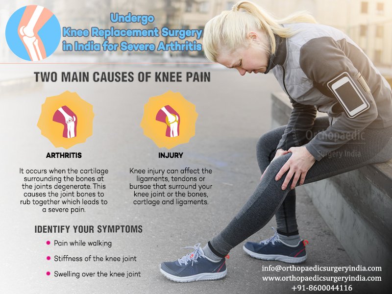 orthosurgeryin's tweet photo. #Knee #replacement #surgery in India for #severe #arthritis is available at the most affordable cost.  visit https://t.co/d9tG0jU2xv https://t.co/Tt3I7vgkyT