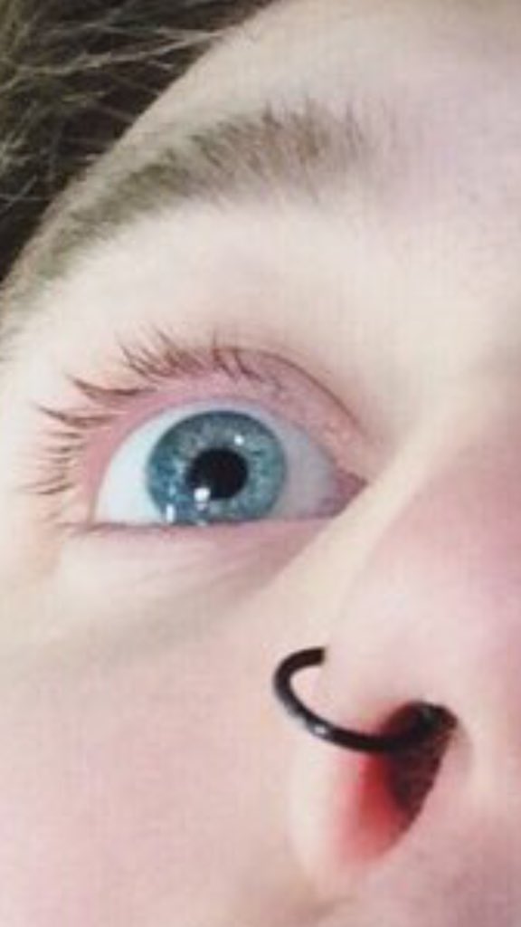River_124's tweet photo. @hiximxnoellex at least that eye still look good though https://t.co/DqzA34rWvC