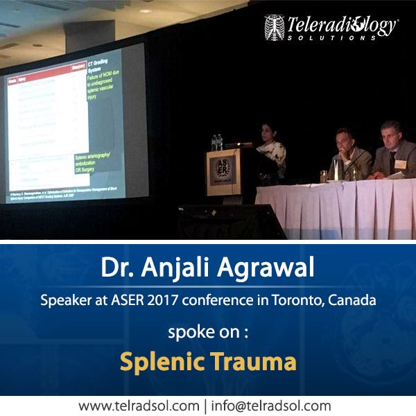 teleradsol's tweet photo. Dr. Anjali Agrawal speaking on the subject of Splenic #Trauma at the ASER 2017 conference in Toronto, Canada #ASERToronto https://t.co/rj1V2qK8GY