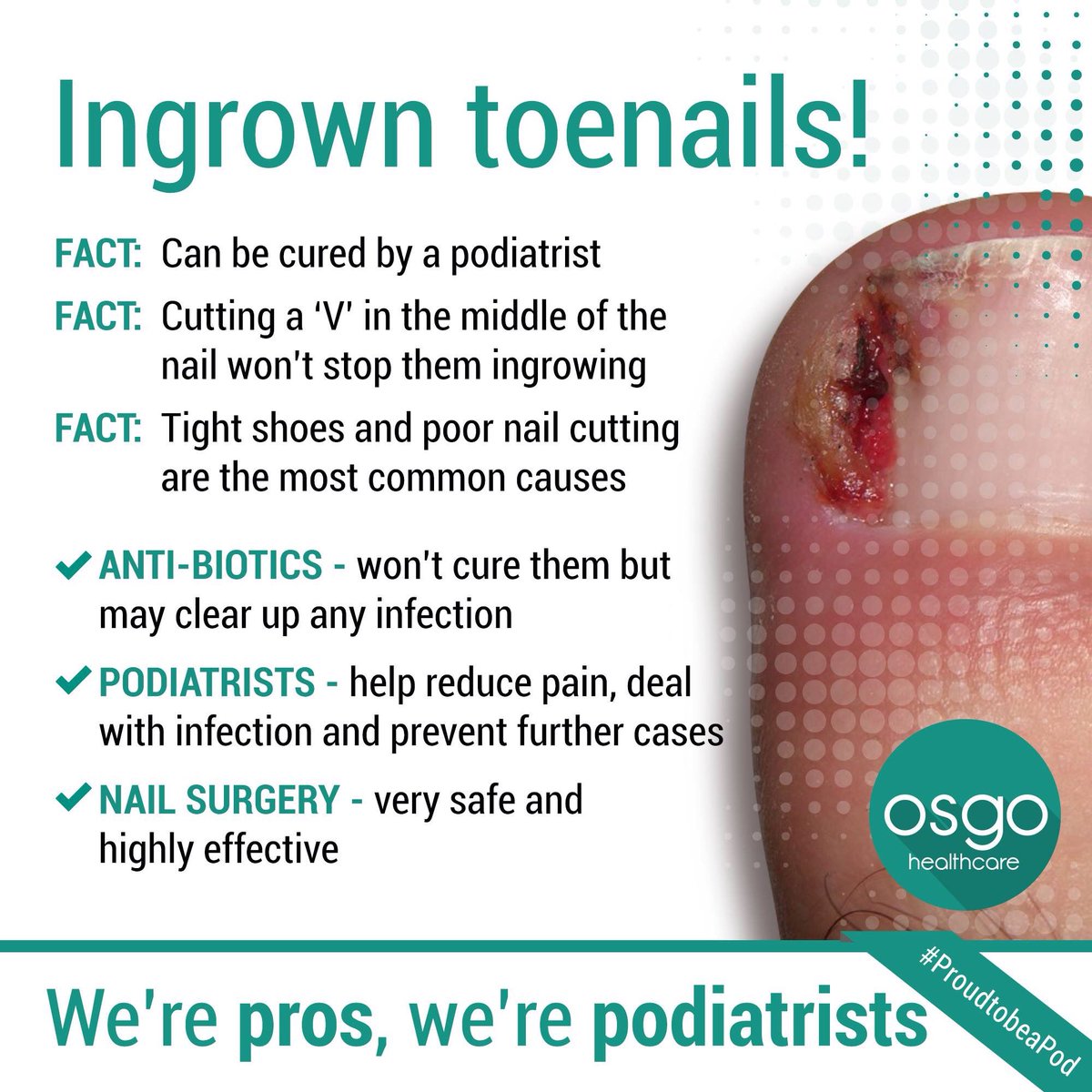 mobilefoot's tweet photo. #ingrown #ingrowing #toenails #podsfixfeet #proudtobeapod #podiatry #chiropody #chiropodist #podiatrist in #sunderland https://t.co/pLLGOl53qM