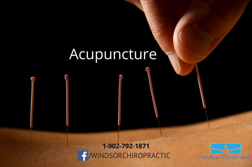 WindsorChiro1's tweet photo. #windsorchiro #getbacktobeingyou #acupuncture https://t.co/7zhZzkYOYS