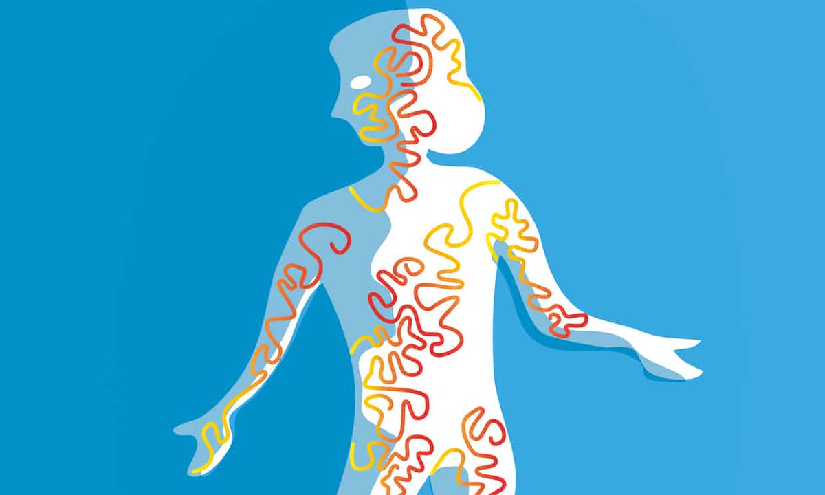 1Antruk's tweet image. Sepsis kills more in the UK than bowel, breast and prostate #cancer combined. So why is so little known about it?theguardian.com/lifeandstyle/2…