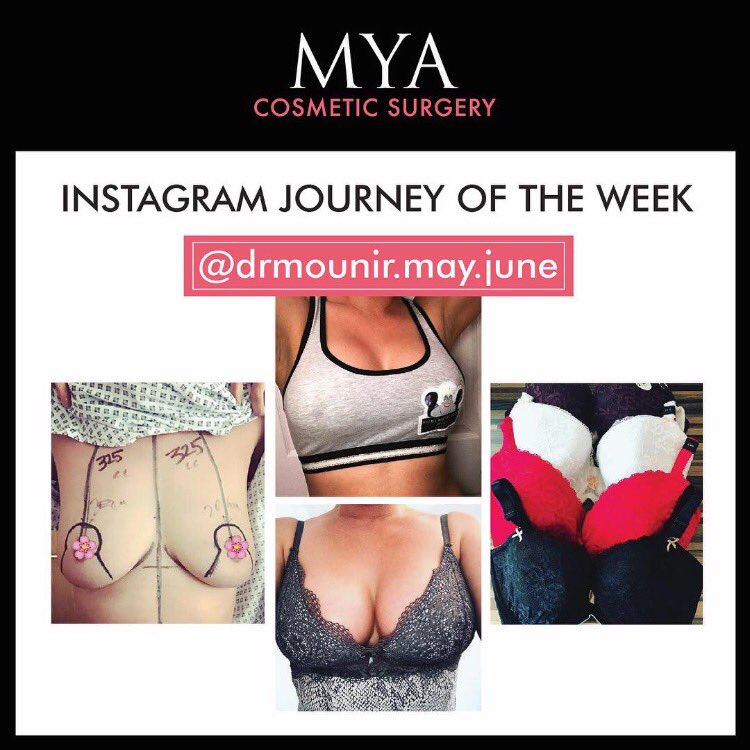 MYA_Tweet's tweet photo. Instagram journey of the week goes to @drmounir.may.june 🍉🍉 check out more #impants #mya https://t.co/uJb227kfoC https://t.co/TGnkSH4ILN