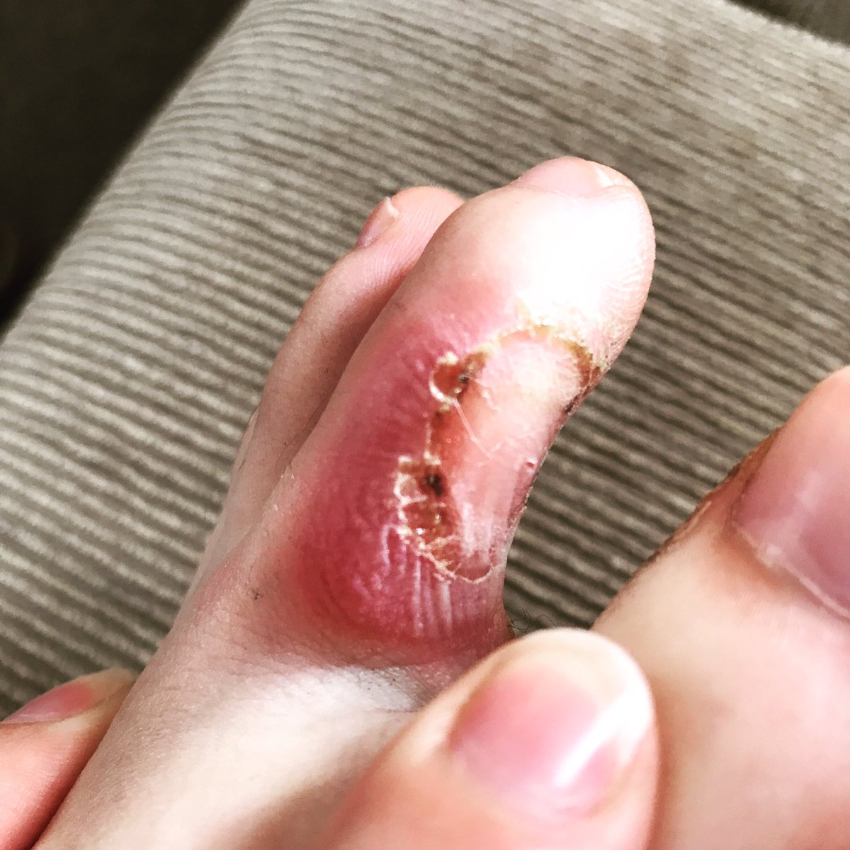 Amazing holiday, Gutted to be back. Got a little gift to remember it by though...😩