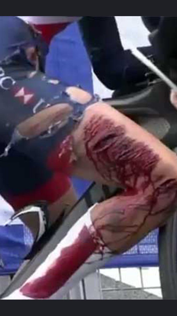 S15GAW's tweet photo. Ouch #gritteeth https://t.co/8J84iPY0ao