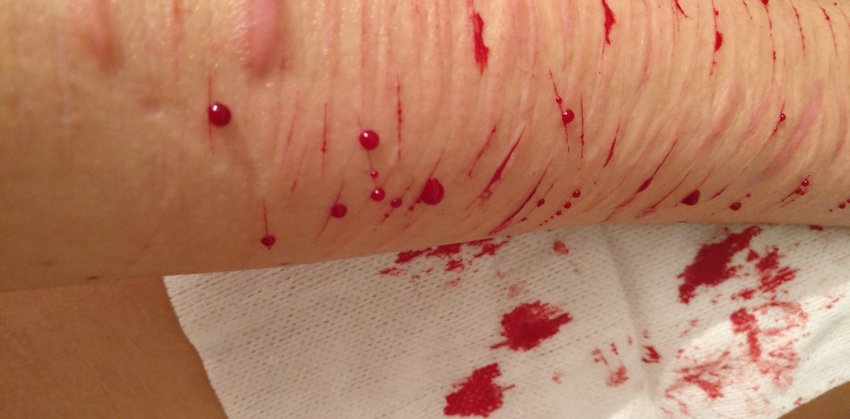 MatOrmenta's tweet image. "Je t'avais promis que tu verrais les étoiles".
Boum.