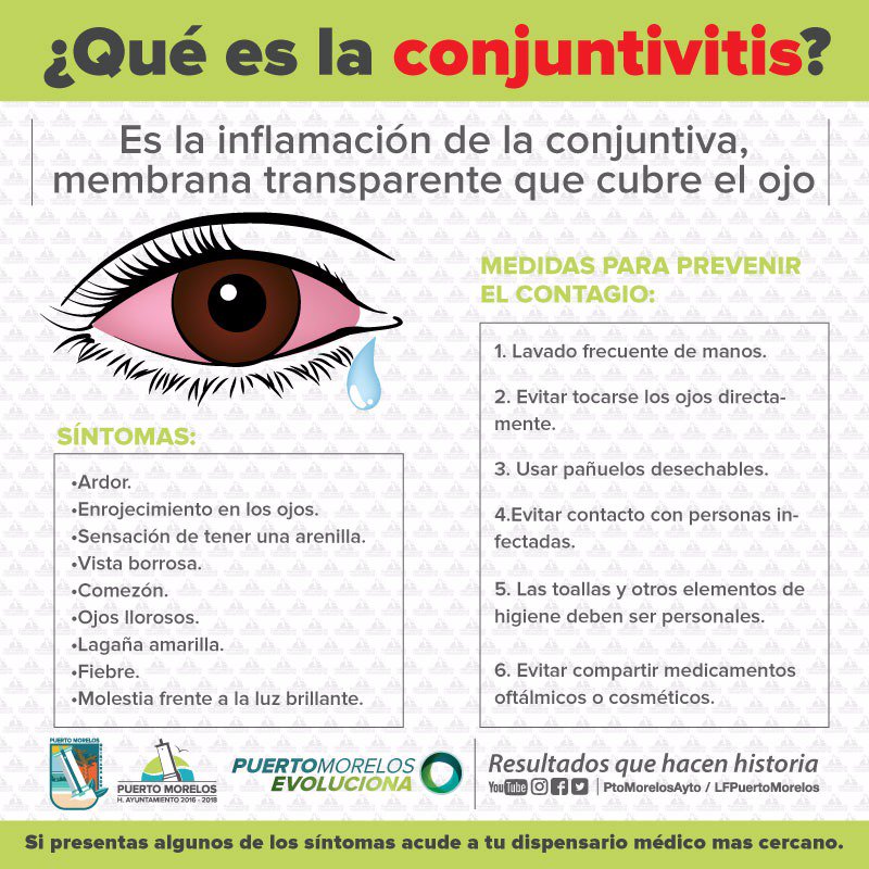 ¿Sabes cuáles son los síntomas de la conjuntivitis y cómo prevenirla?

Comparte esta información.

¡Nuestro Dispensario Médico te informa!