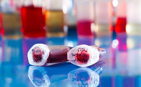 DarrowStemCell's tweet photo. Here’s what you need to know about PLATELET RICH PLASMA THERAPY by #DrDarrow https://t.co/GX51JGVJXg https://t.co/eN5vVsg1ea https://t.co/xmw5pNwPnY