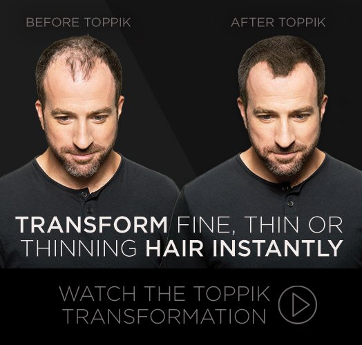 HairFiberZ's tweet photo. How To #Vanish #Baldness #hairloss without #hairtransplant . Try #Toppik and #Caboki for Instant Hair. Watch : https://t.co/EcdjLPjhob https://t.co/Lj5A84an3C