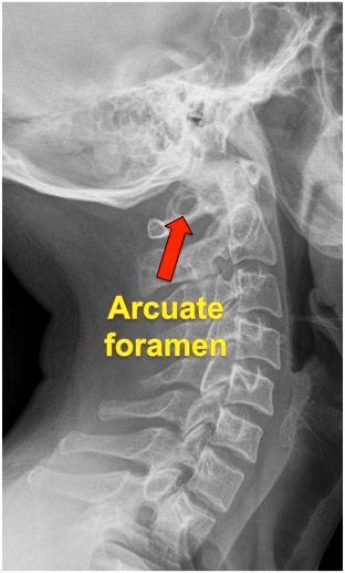 Rad_Bits's tweet photo. Answer Quiz206
#digitalhealth #foamed #foamrad #med13 #imed13 #OnlineLearning #tEMR #Med_student #uqu #isnc #med19 #medical_student #med32 https://t.co/PJ7tZS3yTl