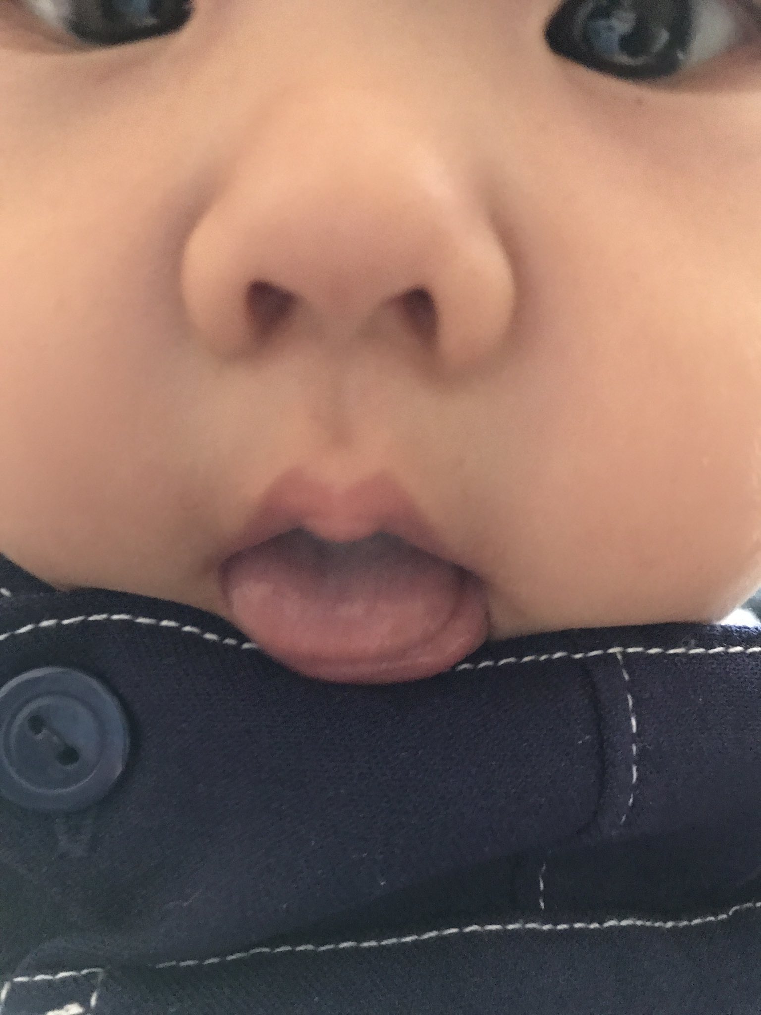 あやなん ねえ 私が今授乳してる時に息子の鼻 の穴の中にちっっこい虫が入っていくのをみたぞ 絶対に入った めっちゃ素早くスンッて入ってった あーもーこれが豚鼻の宿命かよ Wwwあたしもよくチャリ漕いでると入ってくるんだよ