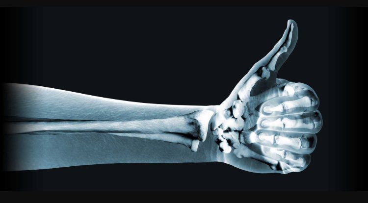 OrthopedicsCT's tweet photo. Thumbs up for Dr.Choo! In pain? Wait no more!! #cfortho #orthopedics #danburyct #likes #wristhand #bones #walkins https://t.co/hEtWknhXAV