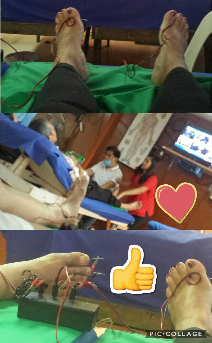 jvcfelix's tweet photo. #2wardsBetterHealth #acupunture @CCP_MlaEastArcade_Taytay https://t.co/9OUeeU7TKi