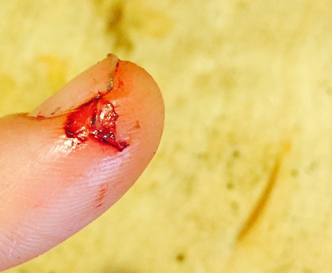 A cheery little cut so happy to be alive so sharp focused intense but so very little fully here and yet will soon be gone #happyfriday