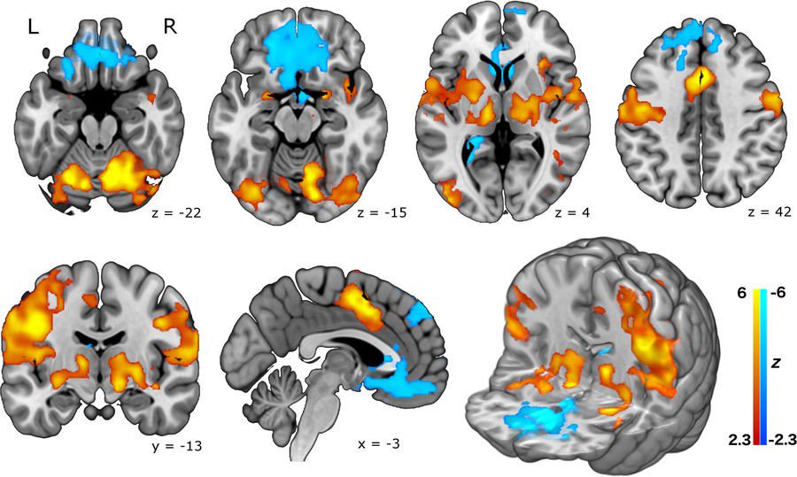 InvicroUK's tweet photo. New study published: Pioneering study reveals #brain effects of #smoking using electronic #cigarettes https://t.co/T8tQCsJFFC https://t.co/Hbm7E2BgAL