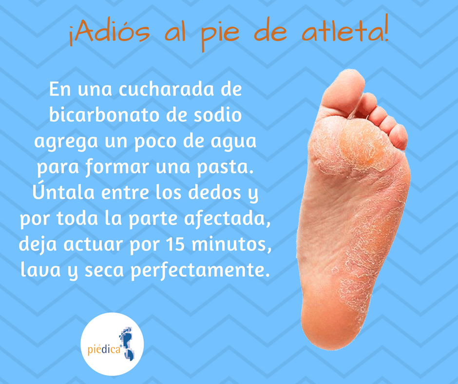 Muchas situaciones peligrosas aeropuerto Tradicional bicarbonato pie de