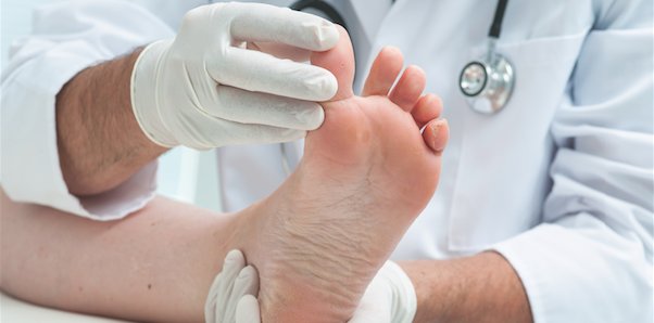 Consultant360's tweet photo. Foot #Pain Often Linked to Knee, Hip Pain // https://t.co/hKito4tvST // #CONpain #rheumatology #CONrheumatology #jointpain #musculoskeletal https://t.co/Bcj98qGFqx