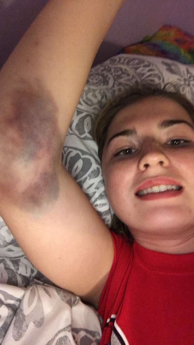 MeganRennerr's tweet photo. #vballproblems @Abbey_Fryauf https://t.co/ExSIkZxobk