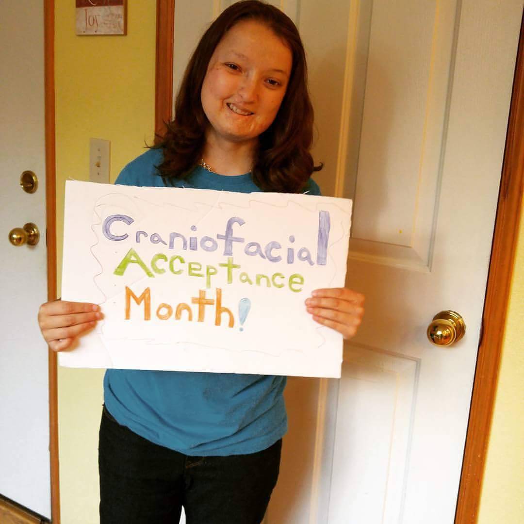 whitebirdmovie's tweet image. A few courageous people that make our world WONDERful! #CraniofacialAcceptanceMonth #WonderTheMovie 💙