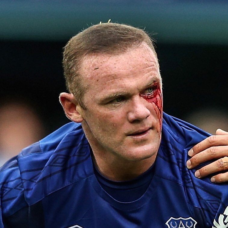 JuanAnderOnly's tweet image. Might have moved to Everton but he still bleeds Red 🔴 💪🏻