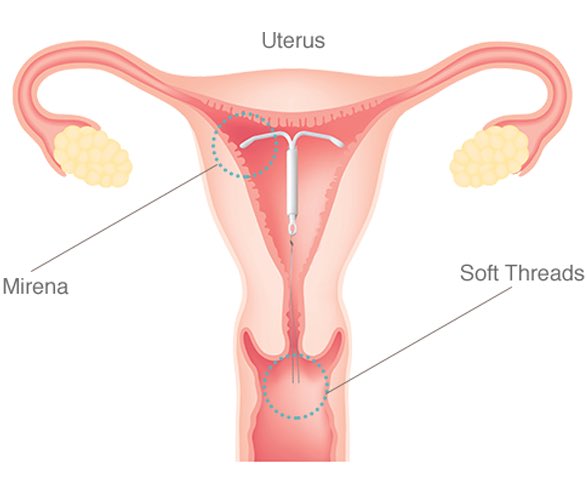 TeslaFanGirl's tweet photo. @ssaig Heh - I always thought it was a uterus and/or iud 😂 https://t.co/5MZ42K1YDY